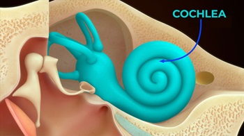 Color illustration of the human inner ear anatomy, with the snail-shaped cochlea labeled.